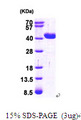 GRHPR / Glyoxylate Reductase Protein