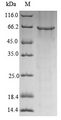 GRIN1 / NMDAR1 Protein - (Tris-Glycine gel) Discontinuous SDS-PAGE (reduced) with 5% enrichment gel and 15% separation gel.
