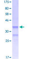 GRK7 / GPRK7 Protein - 12.5% SDS-PAGE Stained with Coomassie Blue.