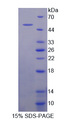 GRM1 / MGLUR1 Protein - Recombinant Glutamate Receptor, Metabotropic 1 By SDS-PAGE