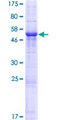 GSG1 Protein - 12.5% SDS-PAGE of human GSG1 stained with Coomassie Blue