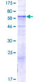 GTDC1 Protein - 12.5% SDS-PAGE of human GTDC1 stained with Coomassie Blue
