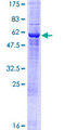 GTF2H3 Protein - 12.5% SDS-PAGE of human GTF2H3 stained with Coomassie Blue