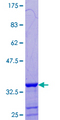 GTF2H5 Protein - 12.5% SDS-PAGE of human GTF2H5 stained with Coomassie Blue