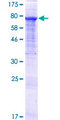 GTF2IRD2 Protein - 12.5% SDS-PAGE of human GTF2IRD2 stained with Coomassie Blue