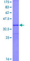 GTSE1 Protein - 12.5% SDS-PAGE Stained with Coomassie Blue.