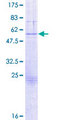 GZMB / Granzyme B Protein - 12.5% SDS-PAGE of human GZMB stained with Coomassie Blue