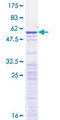 H1FX Protein - 12.5% SDS-PAGE of human H1FX stained with Coomassie Blue