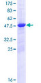 H2AFY2 Protein - 12.5% SDS-PAGE of human H2AFY2 stained with Coomassie Blue