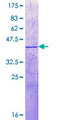 H2BFWT Protein - 12.5% SDS-PAGE Stained with Coomassie Blue.