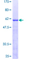 HABT1 / ABT1 Protein - 12.5% SDS-PAGE of human ABT1 stained with Coomassie Blue