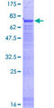 HACD2 / PTPLB Protein - 12.5% SDS-PAGE of human PTPLB stained with Coomassie Blue