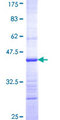 HARS2 Protein - 12.5% SDS-PAGE Stained with Coomassie Blue.