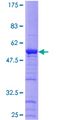 HAUS1 / CCDC5 Protein - 12.5% SDS-PAGE of human CCDC5 stained with Coomassie Blue