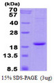 HBA2 / Hemoglobin Alpha 2 Protein