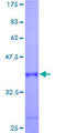 HBG1 / Fetal Hemoglobin Protein - 12.5% SDS-PAGE of human HBG1 stained with Coomassie Blue