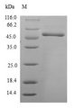 HCCS Protein - (Tris-Glycine gel) Discontinuous SDS-PAGE (reduced) with 5% enrichment gel and 15% separation gel.