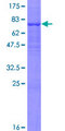 HCF1 / HCFC1 Protein - 12.5% SDS-PAGE of human HCFC1 stained with Coomassie Blue