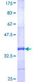 HCP5 Protein - 12.5% SDS-PAGE Stained with Coomassie Blue.