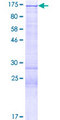 HDAC4 Protein - 12.5% SDS-PAGE of human HDAC4 stained with Coomassie Blue
