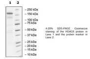 HDAC6 Protein