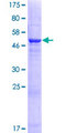 HDHD3 Protein - 12.5% SDS-PAGE of human HDHD3 stained with Coomassie Blue