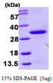 HDHD3 Protein