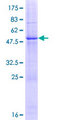 HEATR9 Protein - 12.5% SDS-PAGE of human C17orf66 stained with Coomassie Blue