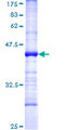 HECTD2 Protein - 12.5% SDS-PAGE Stained with Coomassie Blue.