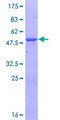 HECTD3 Protein - 12.5% SDS-PAGE of human HECTD3 stained with Coomassie Blue