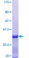 HEDLS / EDC4 Protein - 12.5% SDS-PAGE Stained with Coomassie Blue.