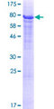 HERPUD2 Protein - 12.5% SDS-PAGE of human HERPUD2 stained with Coomassie Blue