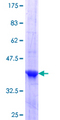HESX1 Protein - 12.5% SDS-PAGE Stained with Coomassie Blue.