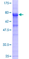 HFip1 / FIP1L1 Protein - 12.5% SDS-PAGE of human FIP1L1 stained with Coomassie Blue