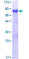 HGH1 / FAM203A Protein - 12.5% SDS-PAGE of human C8orf30A stained with Coomassie Blue