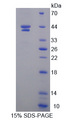 HIF1AN Protein - Recombinant  Hypoxia Inducible Factor 1 Alpha Subunit Inhibitor By SDS-PAGE