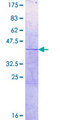 HIST1H2AC Protein - 12.5% SDS-PAGE of human HIST1H2AC stained with Coomassie Blue