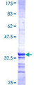 HIST1H2AK Protein - 12.5% SDS-PAGE Stained with Coomassie Blue