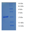HLA-DPB1 Protein