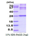 HLA-DRB1 Protein
