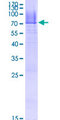 HLA-E Protein - 12.5% SDS-PAGE of human HLA-E stained with Coomassie Blue