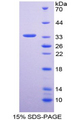 HMG2L1 / HMGXB4 Protein - Recombinant  High Mobility Group Protein 2 Like Protein 1 By SDS-PAGE