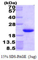 HMGN1 / HMG14 Protein