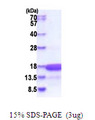 HMGN3 Protein