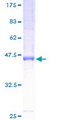 HMP19 Protein - 12.5% SDS-PAGE of human HMP19 stained with Coomassie Blue