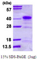 HNRPA1 / HnRNP A1 Protein