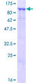 HOOK1 Protein - 12.5% SDS-PAGE of human HOOK1 stained with Coomassie Blue