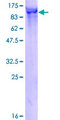 HOOK3 Protein - 12.5% SDS-PAGE of human HOOK3 stained with Coomassie Blue