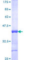 HOXA13 Protein - 12.5% SDS-PAGE Stained with Coomassie Blue.