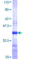 HOXA4 Protein - 12.5% SDS-PAGE Stained with Coomassie Blue.